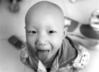 关注大病儿童:先心病、恶性肿瘤儿童