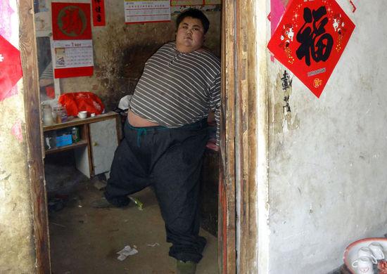 "中国第一胖"心肺衰竭离世 体重高达600斤