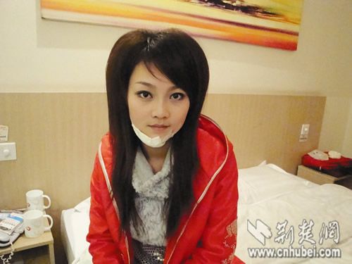 国际旅游小姐摔伤下巴 武汉空军医院紧急修复