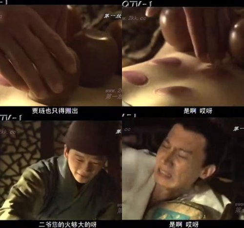贾琏拔罐黛玉裸死 新《红》少红雷人雷语逐个