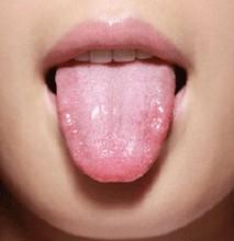 癌症病人的舌头图片