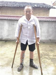 老汉被水泥板砸伤双脚 现无力进行二次手术