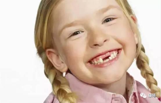 牙医专家:这20种牙颌畸形12岁前必须处理