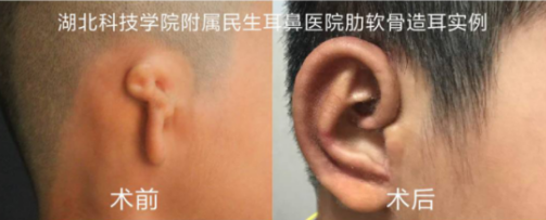 福音耳再造专家章庆国一对一免费面诊会等你报名