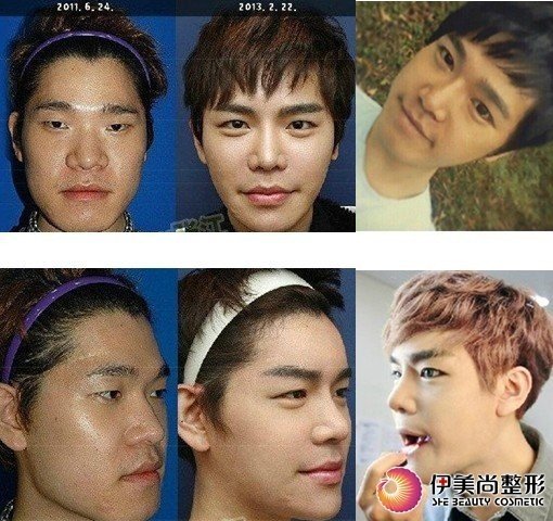  韩国大叔 挨50刀变美男神奇整容史爆红网络