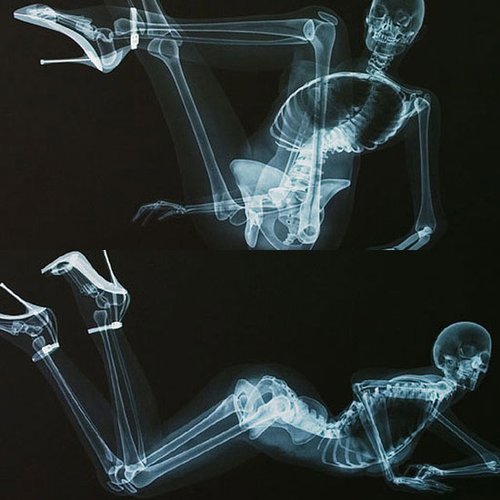 X光版<em>骨感美女</em> 全裸入镜三点不露_腾讯·大楚