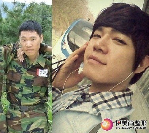  韩国大叔 挨50刀变美男神奇整容史爆红网络_大