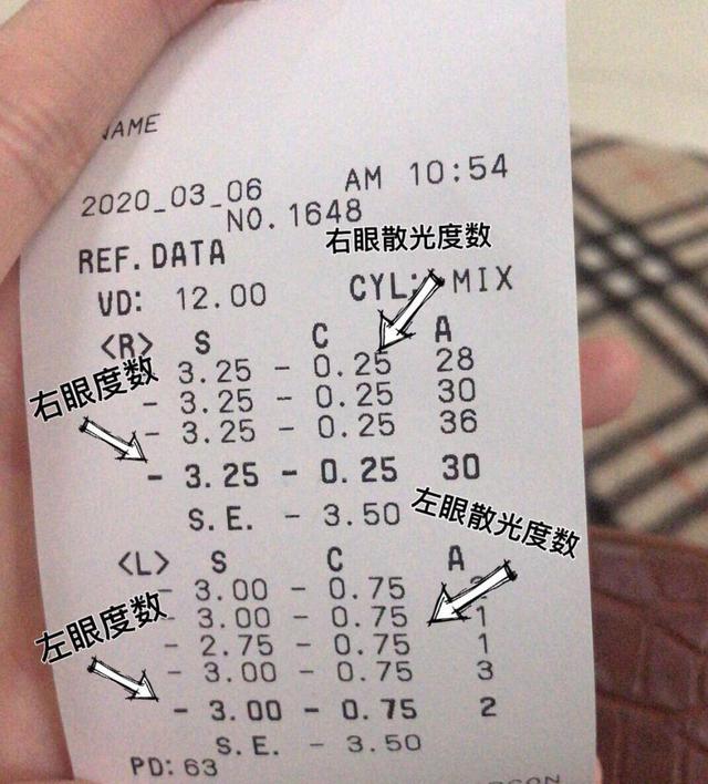 顺便提一下,很多人不知道验光数据要怎么看,小