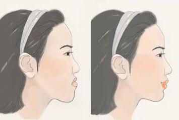 德亚口腔暑期牙齿矫正专场 隐形矫正立减5000