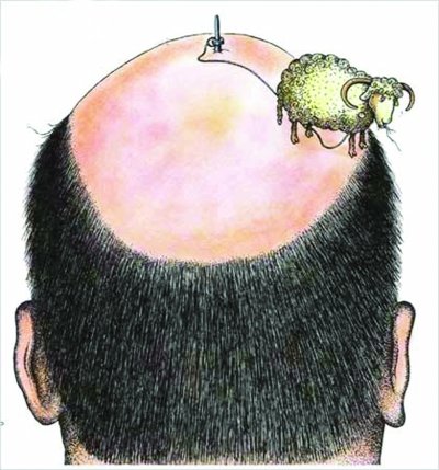 20~40岁男士为脱发主力军 脱发年龄提前20年