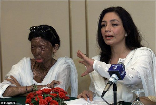 巴基斯坦美艳舞蹈演员被前夫泼硫酸 导致面部