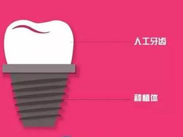 武汉种植牙要多少钱?德亚口腔德系齿科领导者