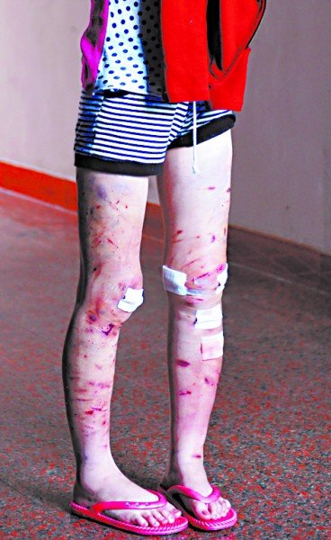 16岁男友遭女生割千刀少女a男友动漫图片图片