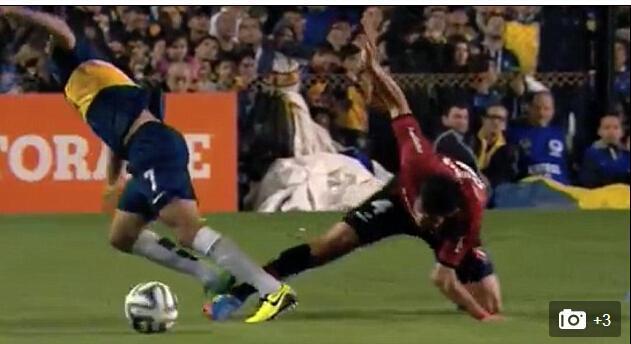 恐怖慎入!阿联赛出惨剧 球员肘部脱臼折90度