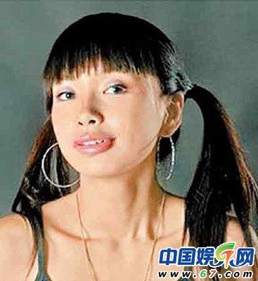 组图:网友首次揭开Angelababy整容全过程_娱乐