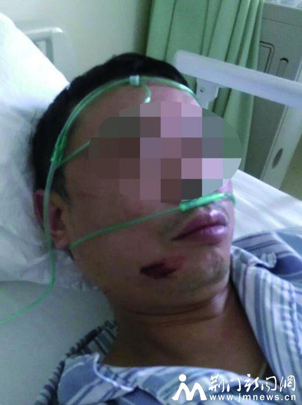  的士被 轿车 追尾  的哥 遭暴打 倒地后不省人事_大