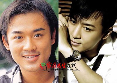 刘恺威郑嘉颖林峰 细数TVB被传整容的男明星