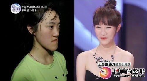 《<em>let美人</em>中国篇》+中国恐龙韩国整容变女神