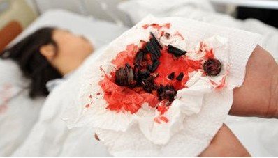 凳子爆炸_液压凳子爆炸_气压凳子爆炸