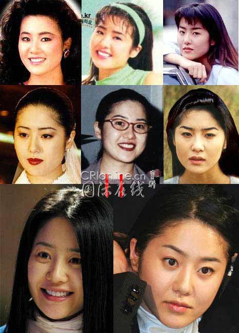 韩国首批整容者遇后遗症 韩恩贞惨变加菲猫(图