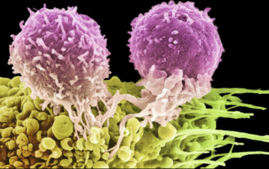 媒体聚焦:T细胞自体免疫疗法让治愈尖锐湿疣成