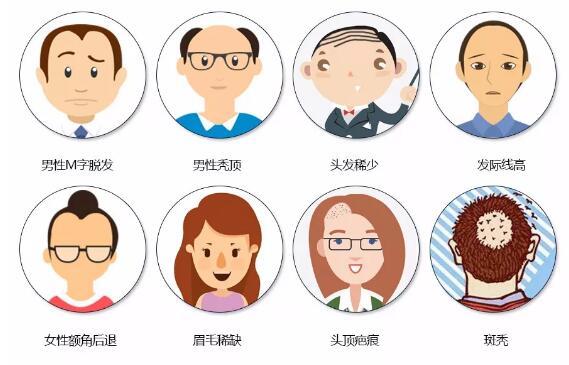 福利:寻1000名脱发秃顶、发际线高的市民免费