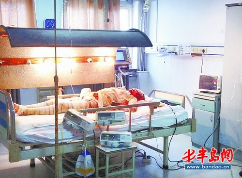 液化气爆炸女子被烧伤<em>感染</em>超级<em>细菌</em>20天未脱