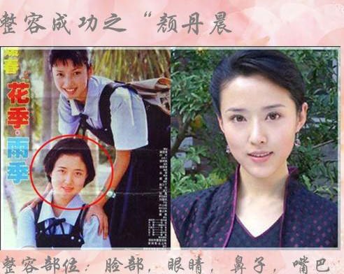 <em>丑女变天仙</em>的整容明星(图)