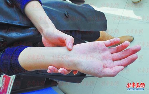 尺侧腕屈肌腱的