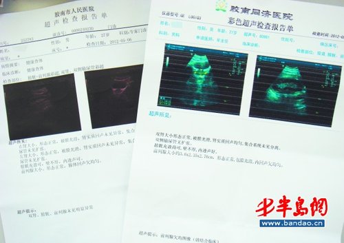 5分钟查出严重前列腺炎?