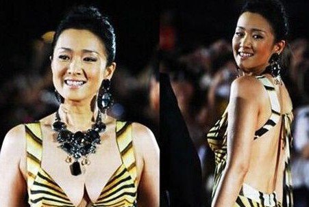 大龄女性胸部下垂也不怕 整形手术方法可矫正