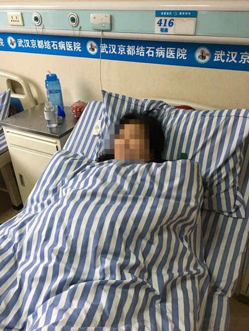 湖北一女子长了四个肾 有种功能远超常人(图)
