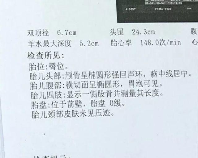 今年4月,刘女士再次怀孕,有出血情况,到龙岗妇幼保健院就诊,医生建议