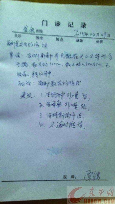 电脑做激光美容女子被导入向视频v电脑5万(图到灼伤相册怎样的上将店家iPhone脸部?里图片