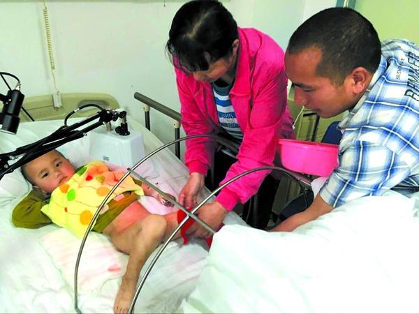 男童抠破火疖子致感染险丢命 医药费高达数十