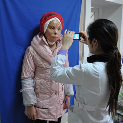 毁容女今接受眼部整形手术