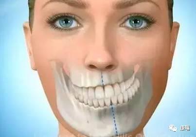牙医专家:这20种牙颌畸形12岁前必须处理