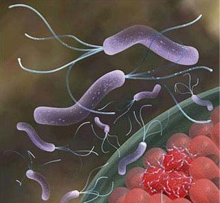 诺贝尔奖得主:幽门螺杆菌有望用于治疗艾滋病