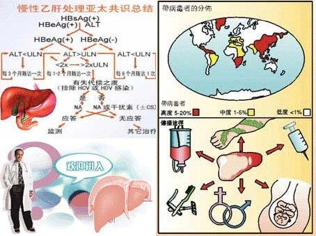 乙肝病毒携带者数量全球3.5亿 中国近1亿