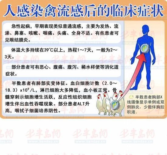 北京新确诊人感染H7N9禽流感病例病情加重