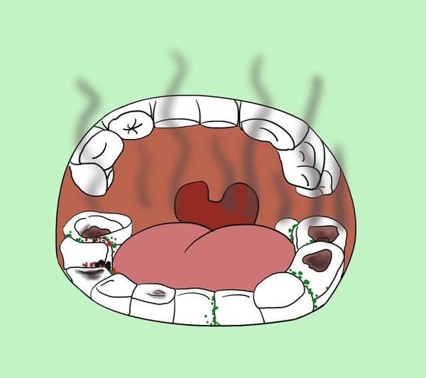 为什么99%的人都存在口臭 如何去除口臭