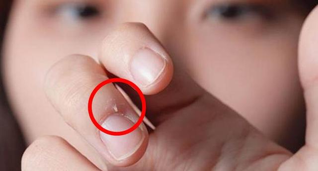 秋季手上出现3种情况别忽视,以茶排毒