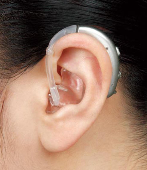爱耳日：购买助听器需要知道3个常识