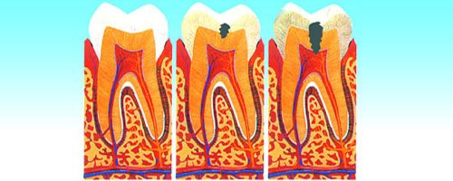 卫生部调查:我国成人龋病患病率88.1%_频道_腾讯网