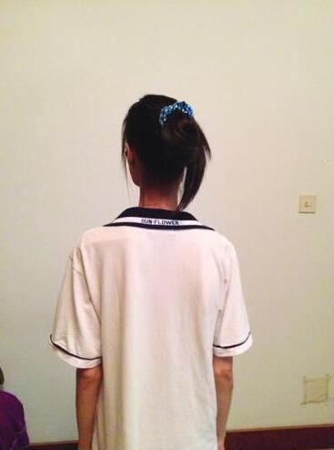 蜂蜜回来减女孩成"衣架"花40万胖不节食肥瘦水v蜂蜜能白醋吗图片
