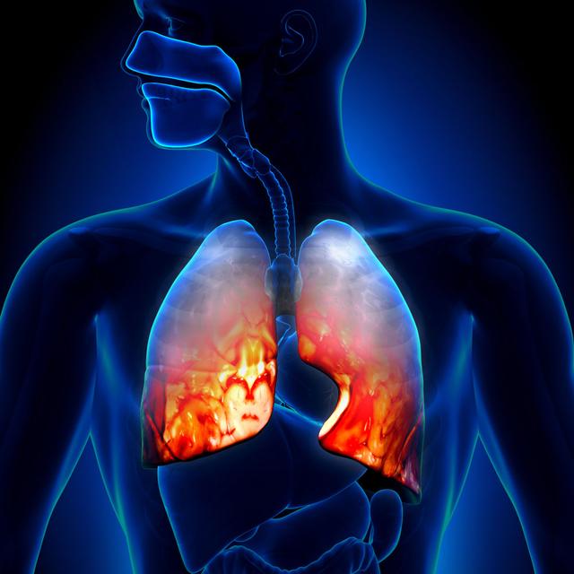 慢阻肺:什么原因导致肺失去康复能力?