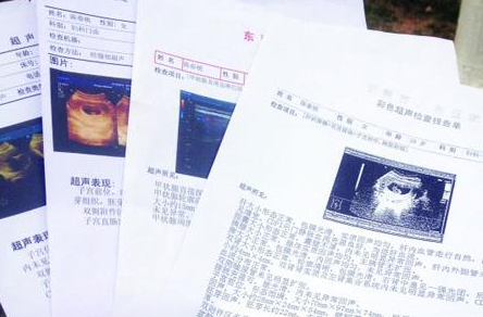 涨姿势 教你读懂胎儿求救信号 