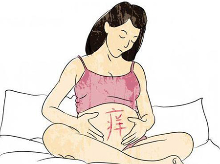 妊娠紋癢怎麼辦？孕晚期妊娠紋癢止癢好方法 健康 第1張