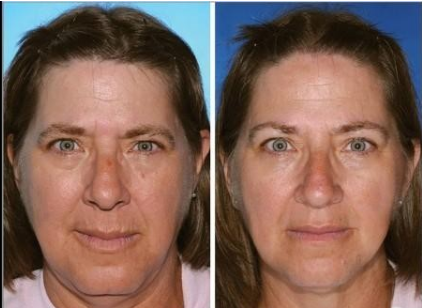 美大学一项研究发现吸烟会加速脸部老化