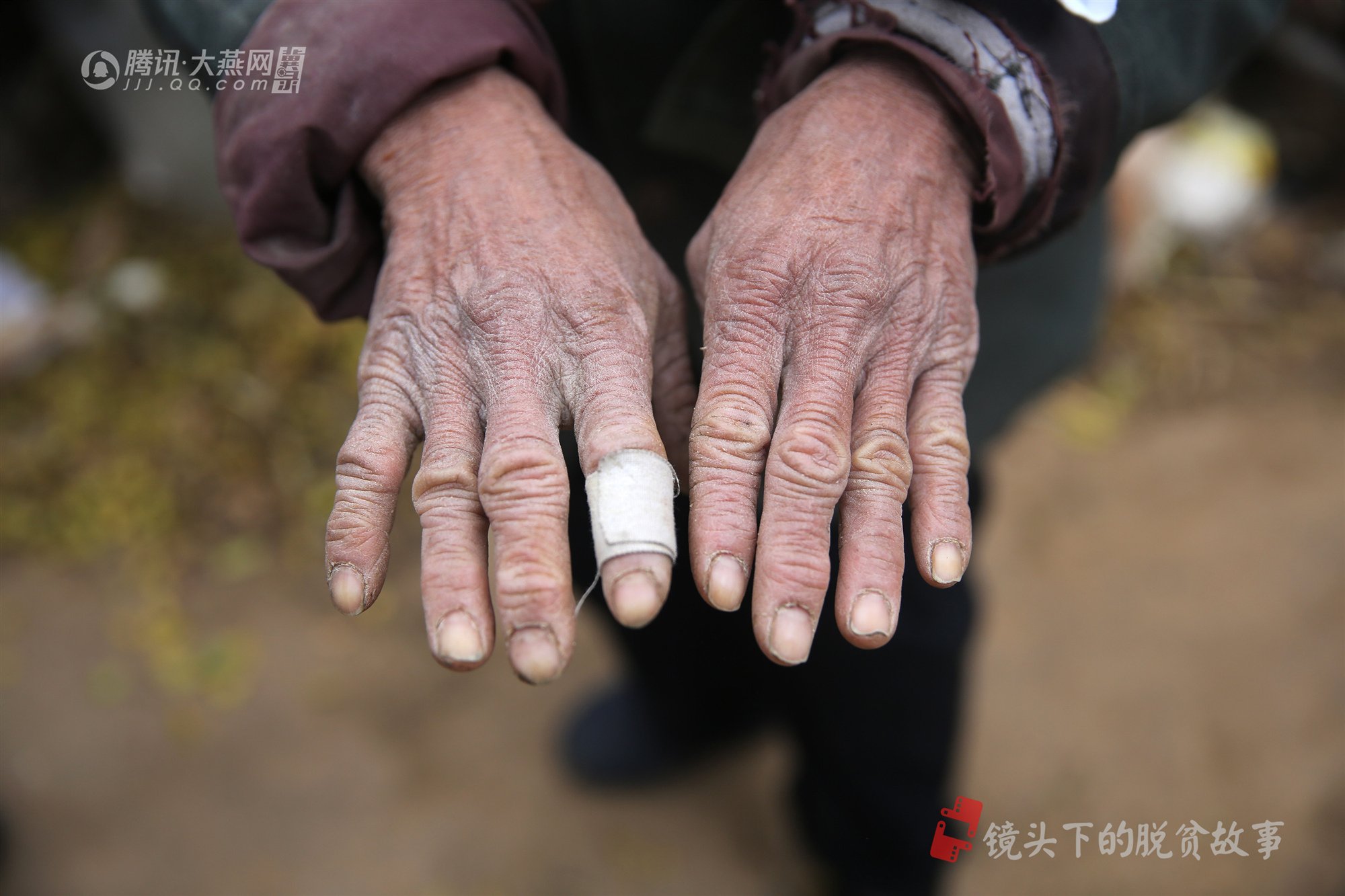 村里一些老人的手由于长期干活大多数皮肤黝黑,粗糙,一到冬天,手都